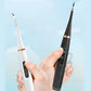 🏆 Last Day Special Price £10.99 !🦷Electric Ultrasonic Dental Scaler for Tartar and Plaque Removal✨