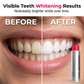 🦷 50% OFF NOW ! ⚡ Stain‑Removing Whitening Mouthwash – Deep Clean Stains, Brighten Teeth & Freshen Breath Instantly ✨